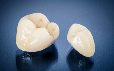 Two dental crowns