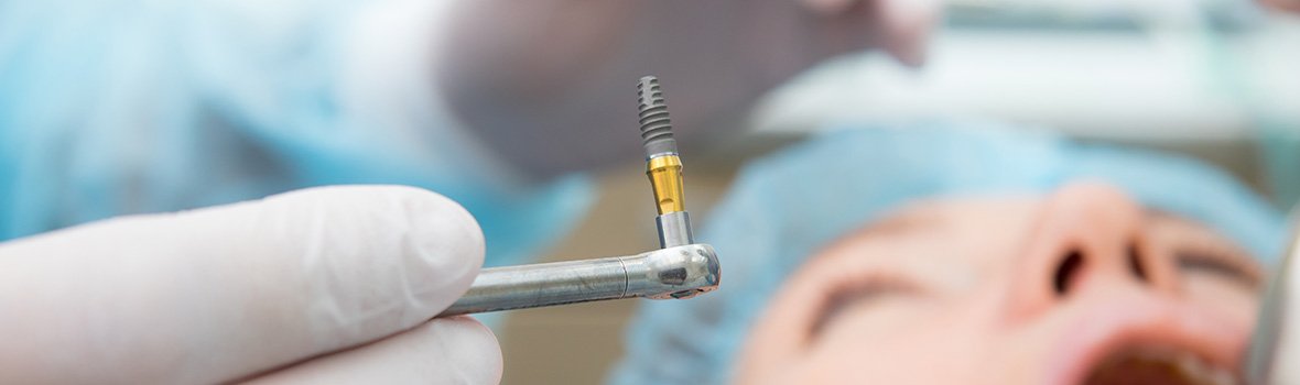 Dental implant salvage treatment may prevent dental implant failure
