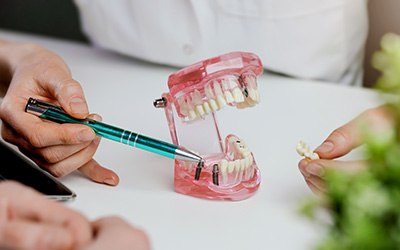 Dental implants can fail due to improper osseointegration